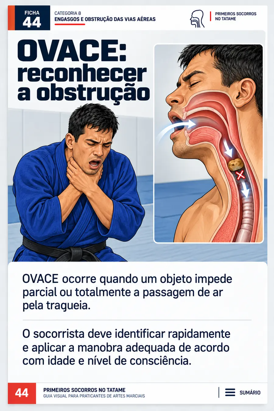 OVACE reconhecer a obstrução